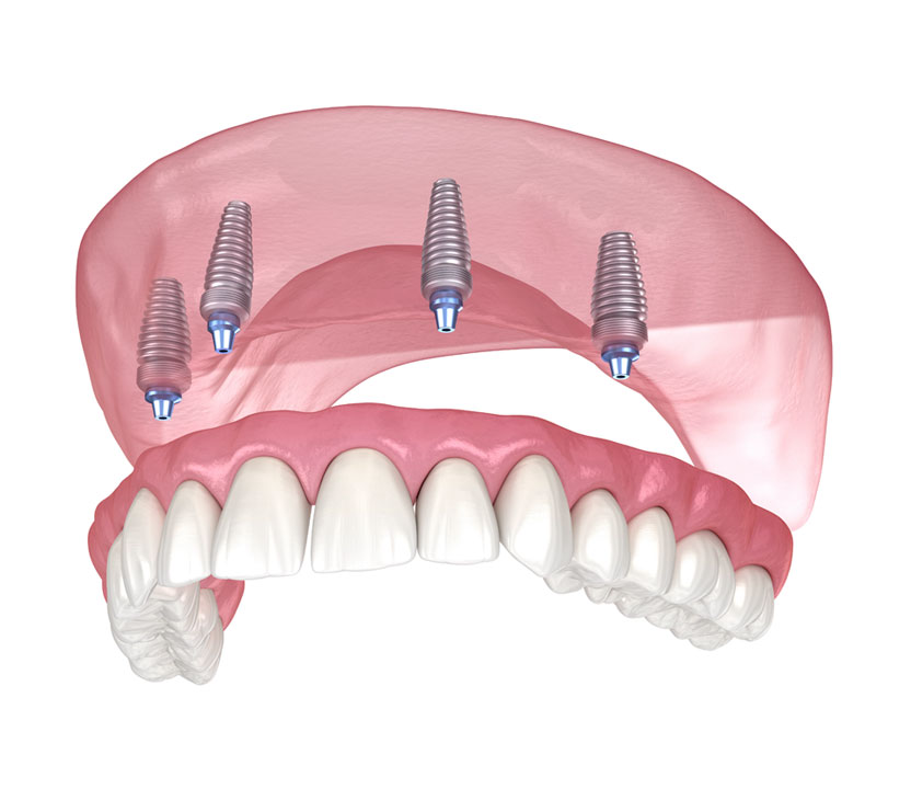 MedicaCity Clinic – Best Aesthetic Care in Turkey