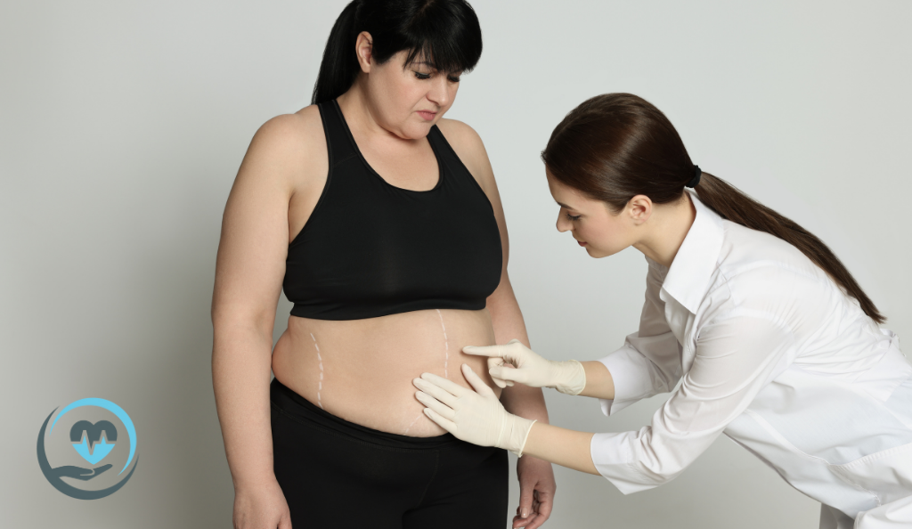 Medicacity Clinic : votre destination de confiance pour l'abdominoplastie professionnelle - Réalisez le ventre de vos rêves avec des soins d'experts !